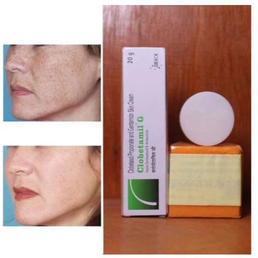 👉Clobetamil-G Premium Melasma Care Combo